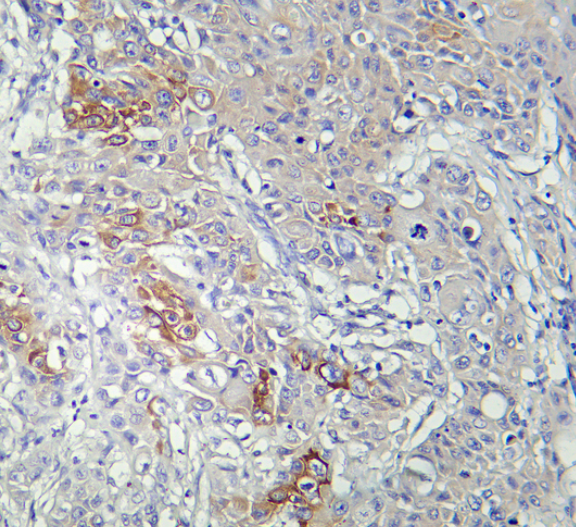 AMPK &alpha;1 Rabbit mAb