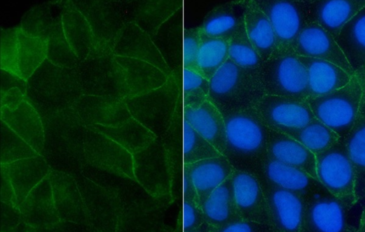 IGF-I receptor beta (YD12231) Rabbit mAb