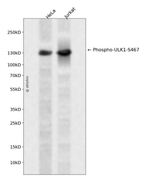 Phospho-ULK1 (Ser467) pAb