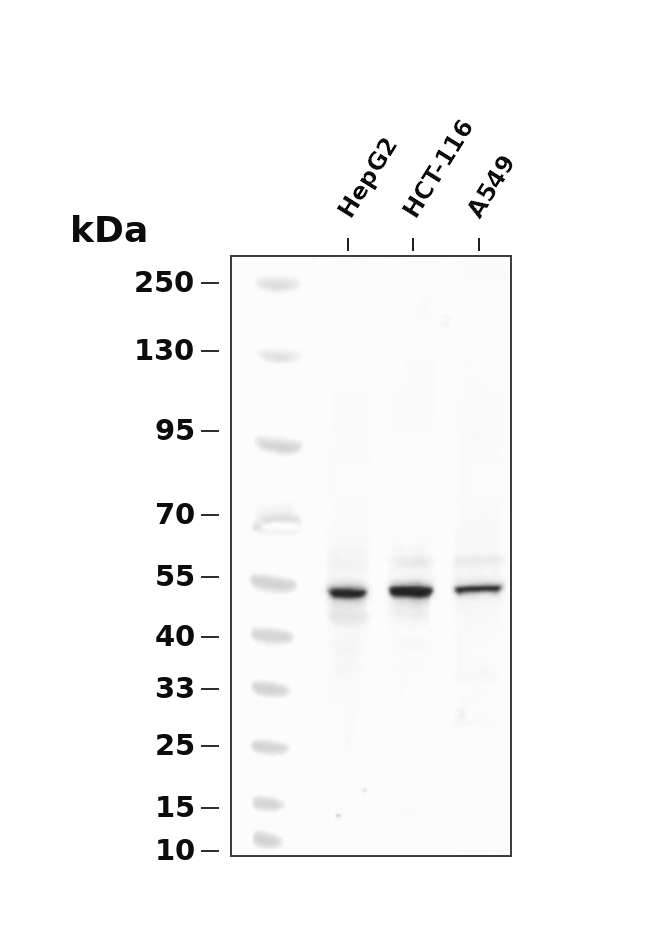 CaMKII &beta; Rabbit mAb