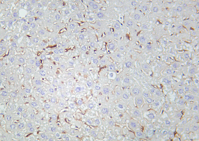 CD86 Rabbit mAb
