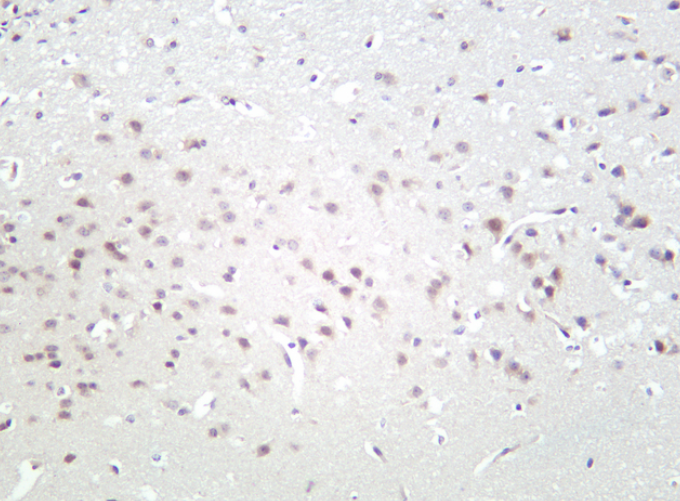 CDC37 (Phospho Ser13) Rabbit mAb
