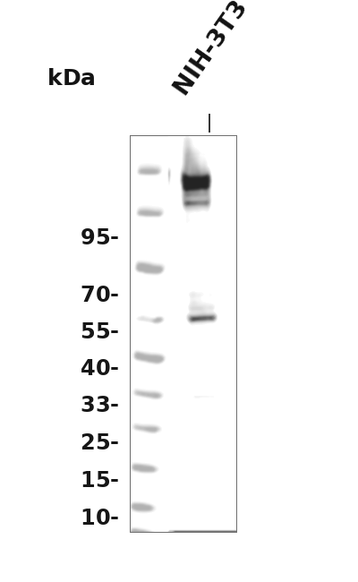 Phospho-PDGFR beta (Tyr751) (YD16422) Rabbit mAb