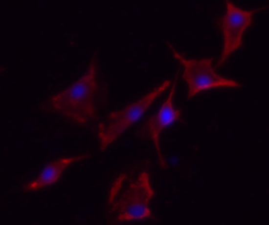 eNOS (Phospho Ser1177)  Rabbit mAb