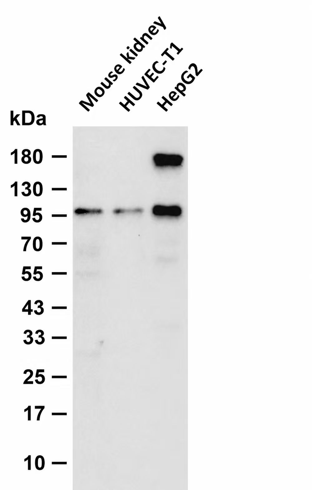 ABCG1  Rabbit mAb