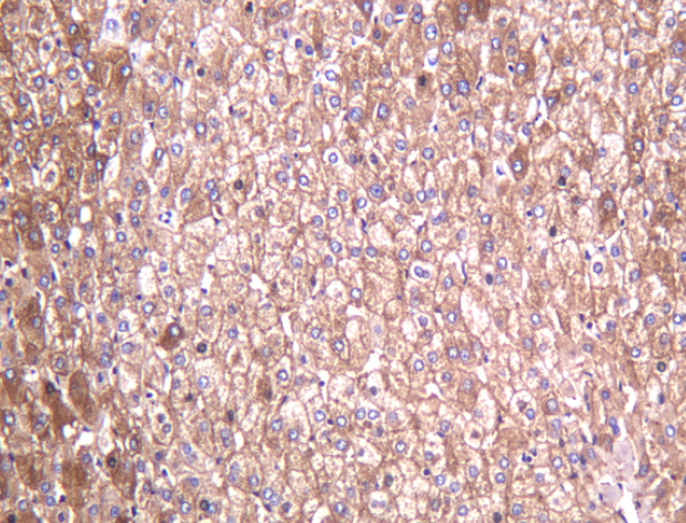 ALDH1L1 Rabbit mAb