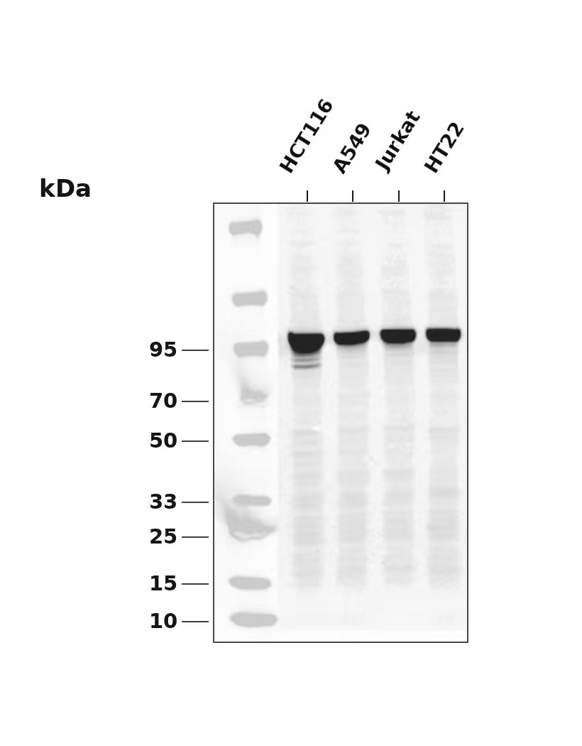 Actinin-&alpha;1  Rabbit mAb