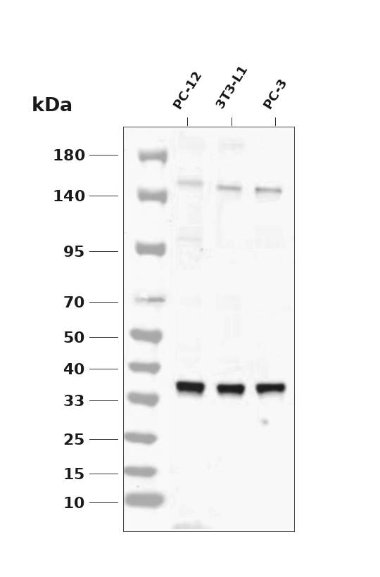 eIF2&alpha; (Phospho Ser51)  Rabbit mAb