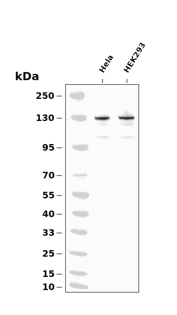 ABL1 Rabbit mAb