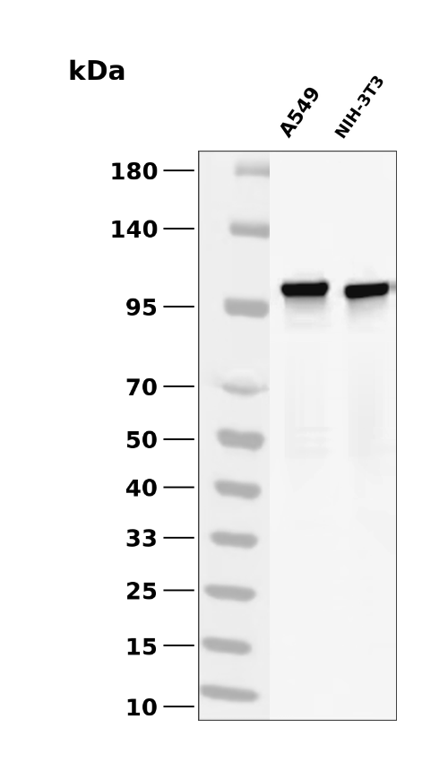 IGF-I receptor beta (YD12231) Rabbit mAb