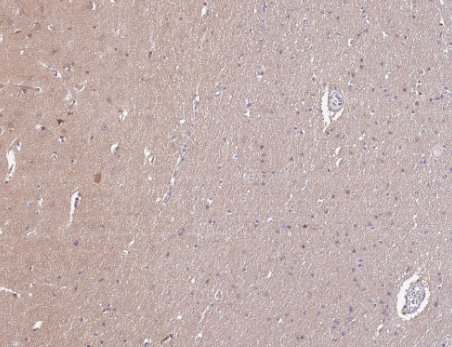 STIP1 Rabbit mAb