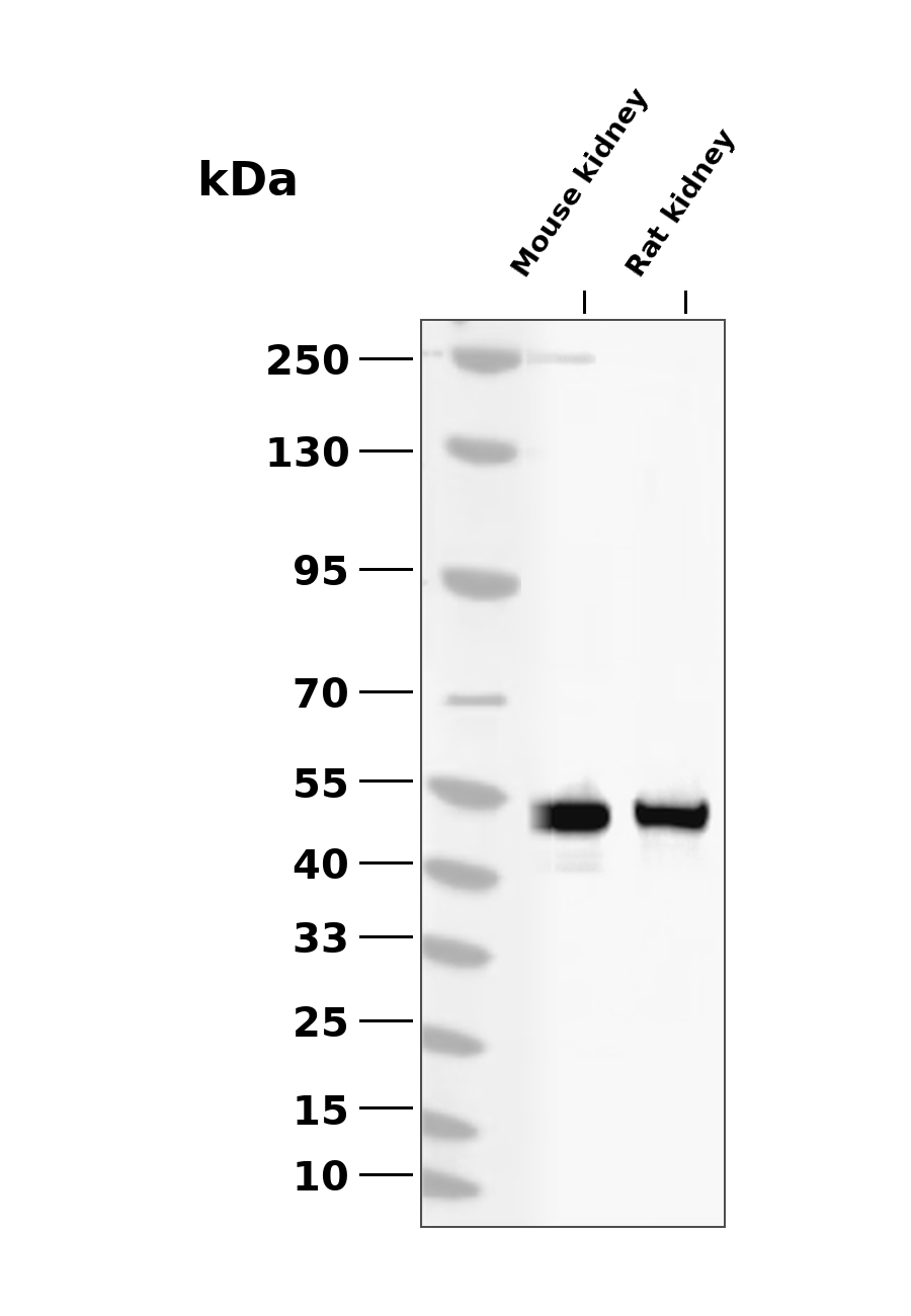 Legumain (LGMN) Rabbit mAb