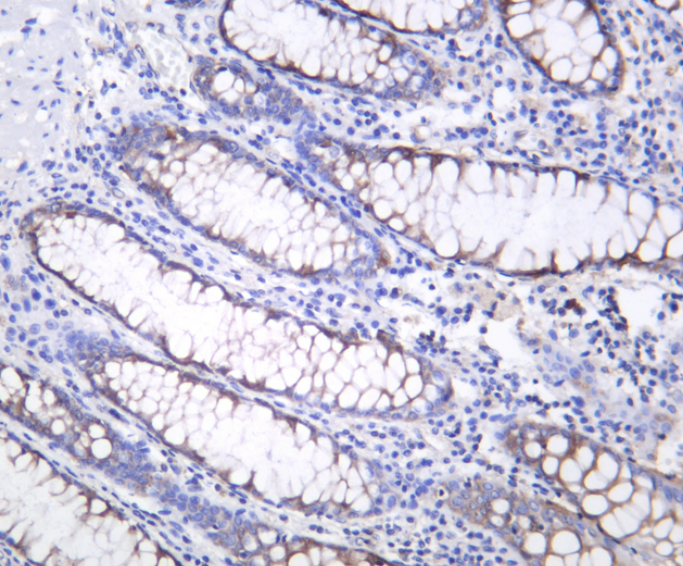 AMPK&beta;1  Rabbit mAb