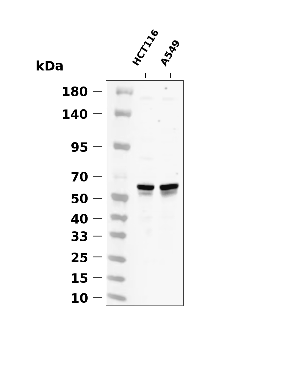 Phospho-AMPK alpha 2 (Ser345) (YD36198) Rabbit mAb