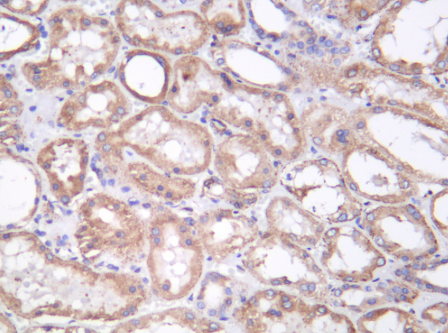 SERCA2  Rabbit mAb