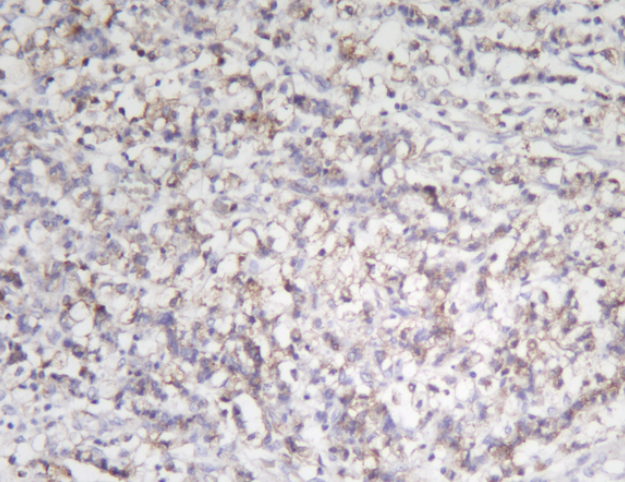VEGF Receptor 1 Rabbit mAb