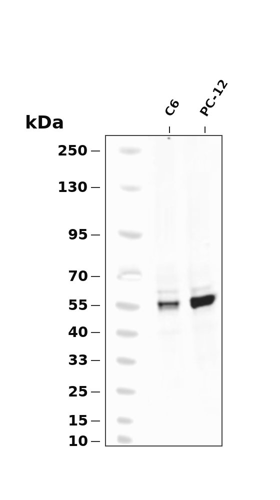 CaMKII &alpha;/&beta; (Phospho Thr286)  Rabbit mAb