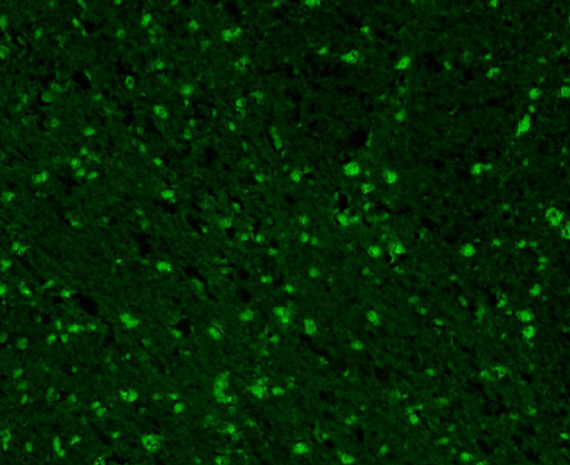 DRP1 Rabbit mAb