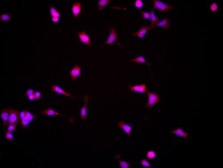 CDK4 Rabbit mAb
