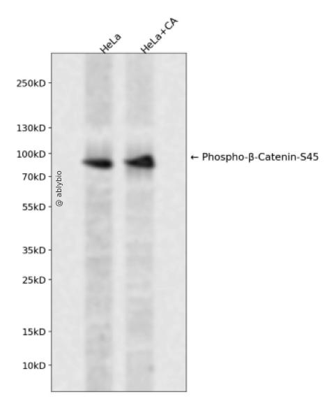 Phospho-beta-Catenin (Ser45) pAb