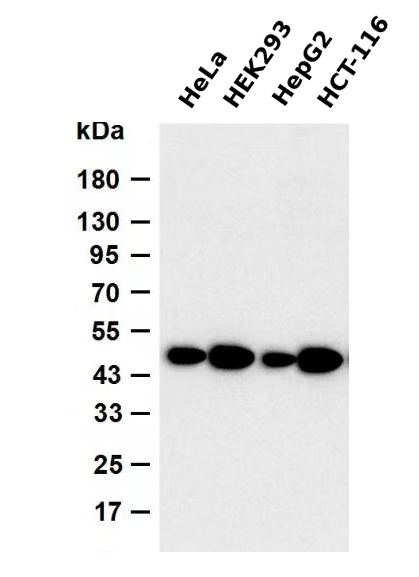 Wnt5b  Rabbit mAb