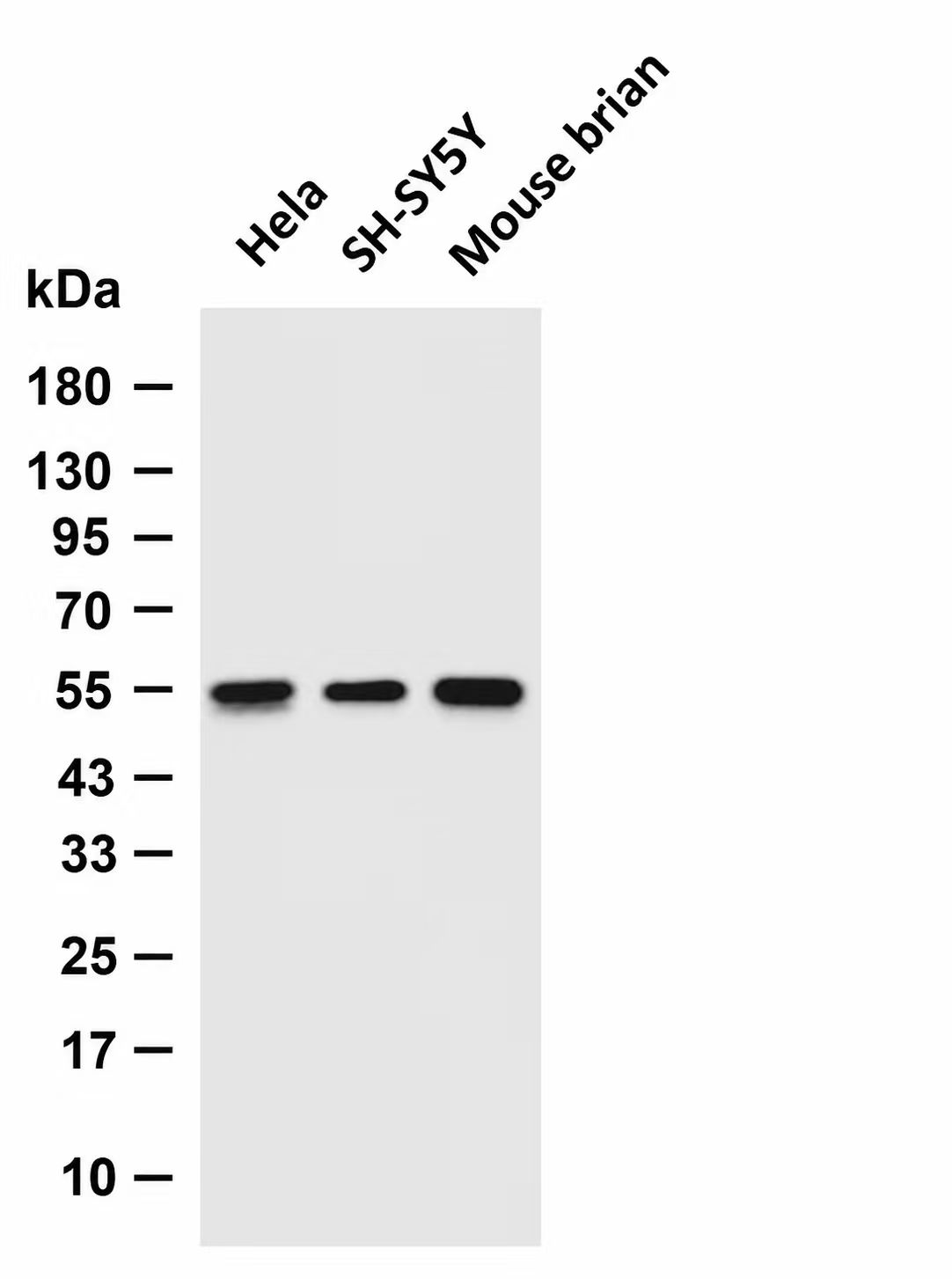 Western blot - CaMKII delta Rabbit