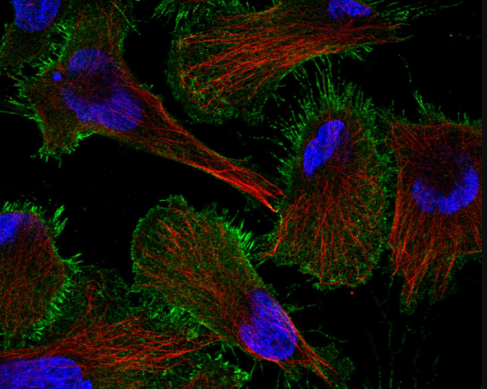 ErbB-3 Rabbit mAb