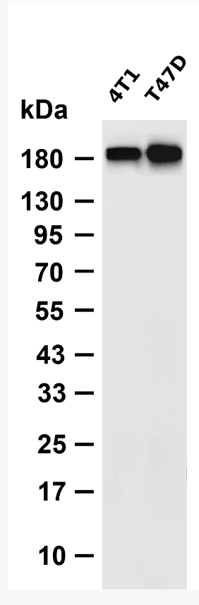 ErbB-3 (Phospho Tyr1289)  Rabbit mAb