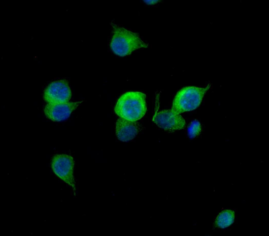 RIP3 Rabbit mAb