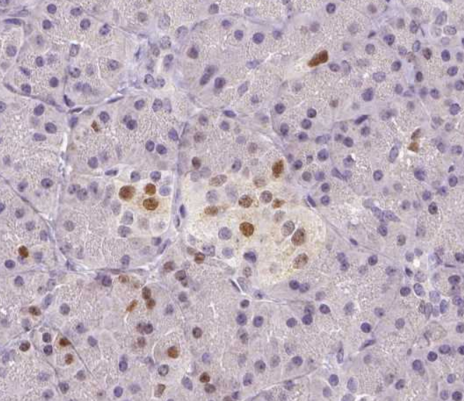 p21 Rabbit mAb