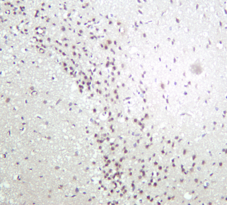 Cdc37 Rabbit mAb