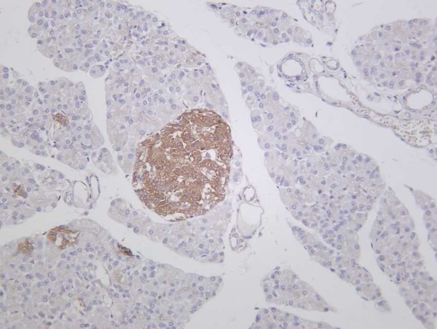 DRP1 Rabbit mAb