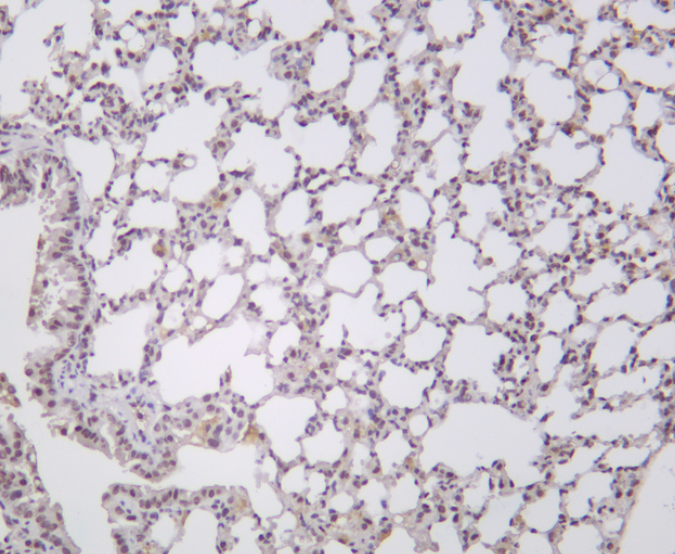 ATF-4 Rabbit mAb
