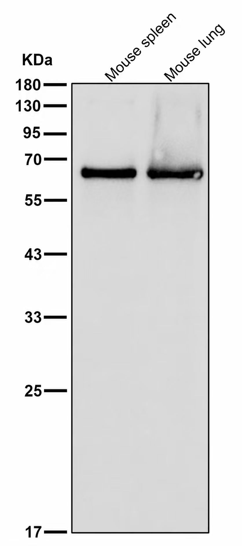 CD86 Rabbit mAb