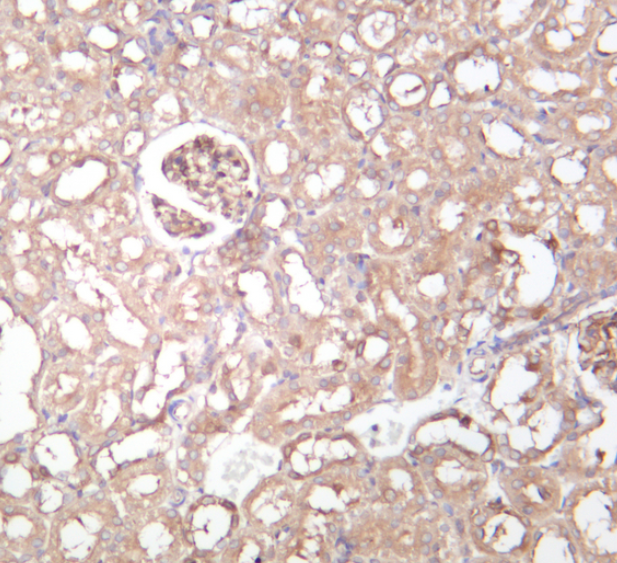 Beclin 1 (YD14294) Rabbit mAb