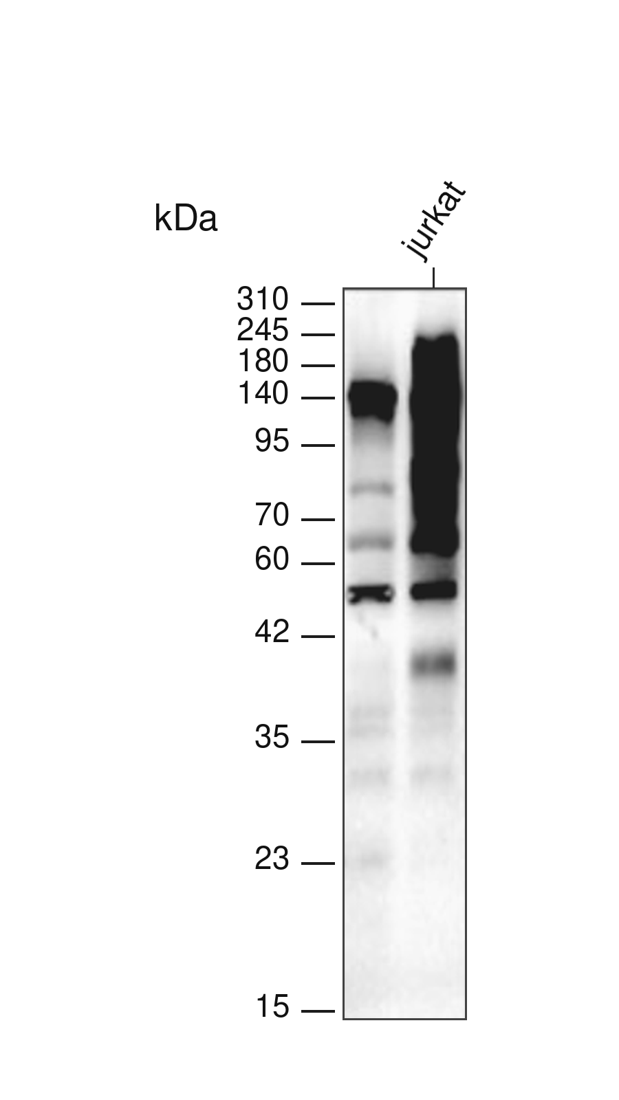 Phospho-Tyrosine (YD12321) Rabbit mAb