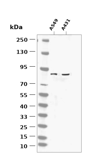 DRP1 (YD12235) Rabbit mAb