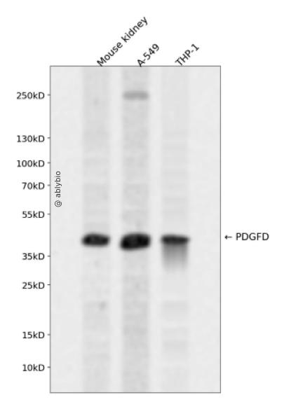 PDGFD (YD16959) Rabbit mAb