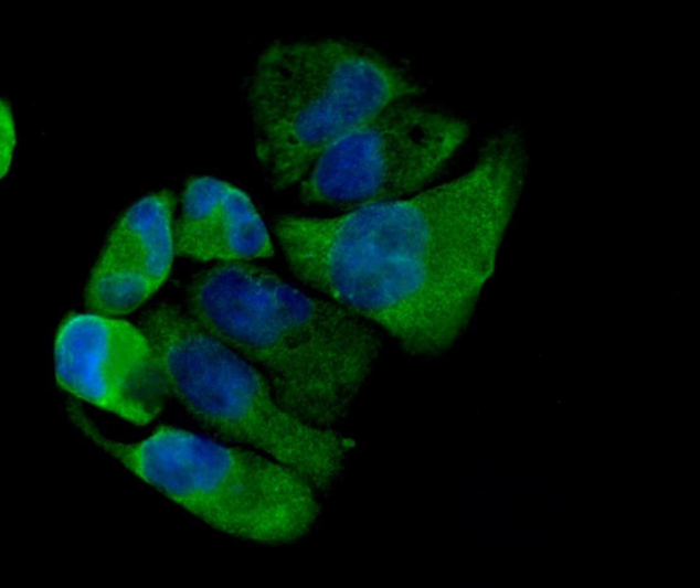 TFEB Rabbit mAb