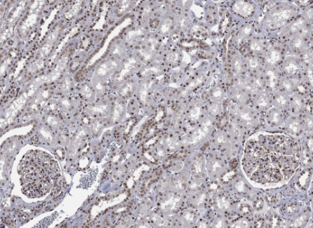 SMC3  Rabbit mAb