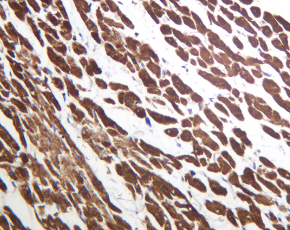 SERCA2  Rabbit mAb