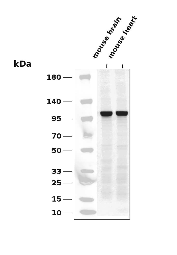 Actinin-&alpha;2 Rabbit mAb