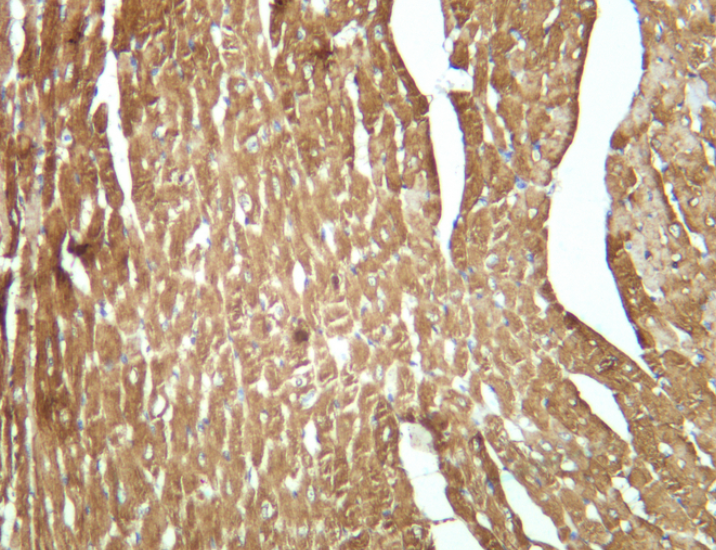 Actinin-&alpha;2 Rabbit mAb