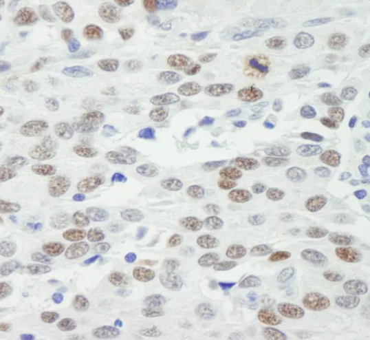 CD206/MRC1 Rabbit mAb