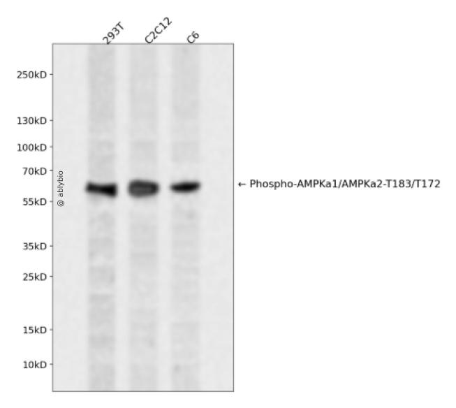 AMPK &alpha;1/2 (Phospho-Thr183/Thr172)  Rabbit mAb