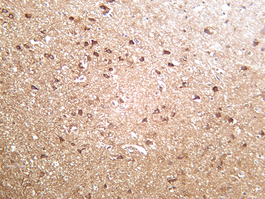 DRP1 Rabbit mAb