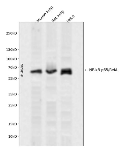 NF-&kappa;B p65 (Phospho-Ser281) Antibody