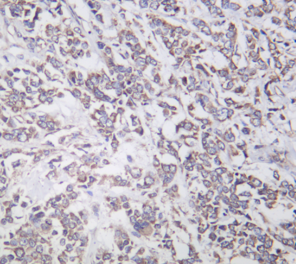 Actinin-&alpha;1  Rabbit mAb