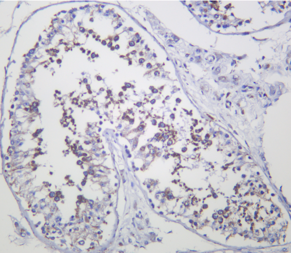 CYP17A1 Rabbit mAb