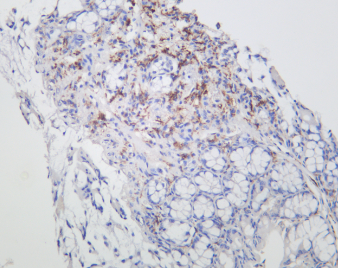 CD206/MRC1 Rabbit mAb